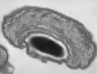 Brevibacillus laterosporus