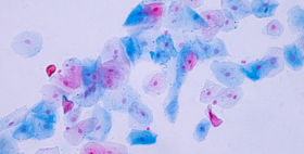 Pap Test